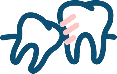 Extractie dentara