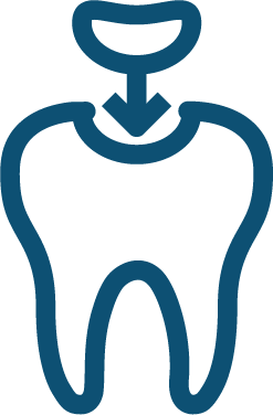 Tratamentul cariei dentare